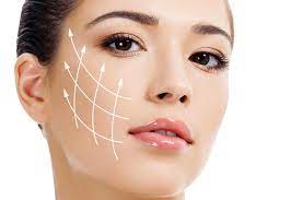 bioestimuladores de colágeno