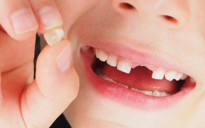 Perda Precoce de Dentes de Leite