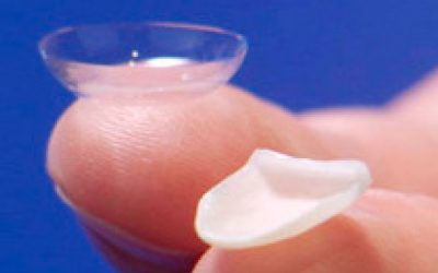 Lente de contato dental