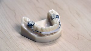 lip bumper