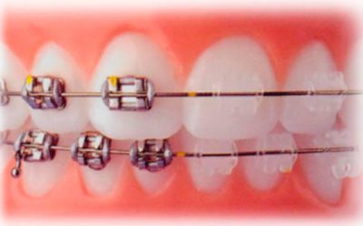 Procurando ortodontista em Porto Alegre?