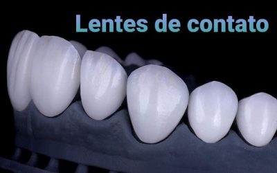 Lentes de Contato X Desgaste
