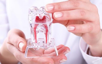 Por que fazer Tratamento de Canal?