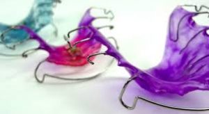 contenção ortodôntica