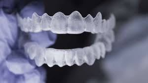 contenção ortodôntica