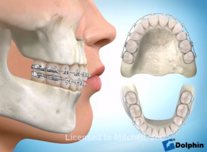 perfil facial hamônico