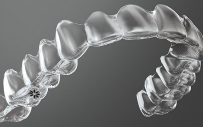 Contenção ortodôntica: Por que?