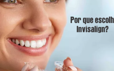 Review alinhadores transparentes adultos