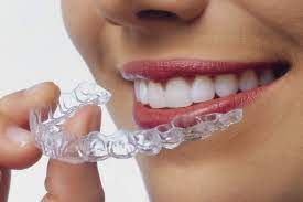 invisalign colocação