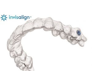 Invisalign