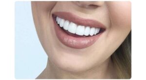 clareamento dental